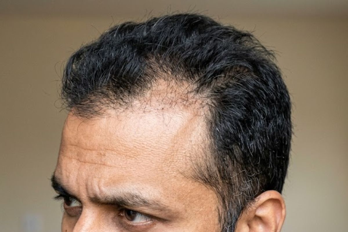Before treatment